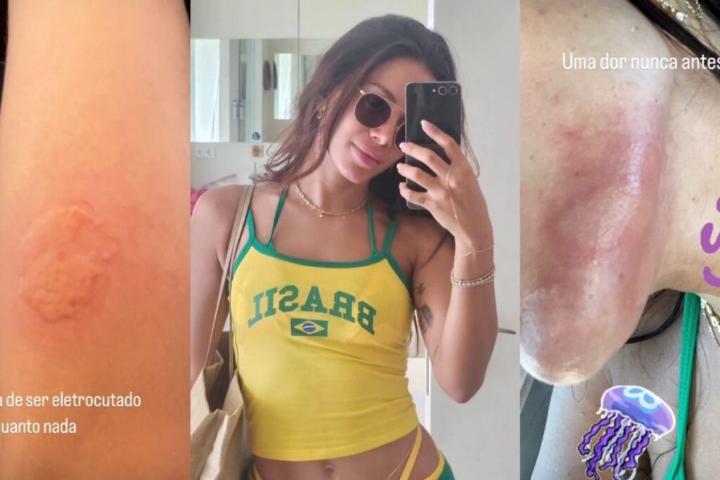 Leia mais sobre a Anitta